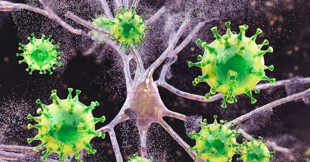 Measles Is Causing Brain Swelling in Children in South Carolina Measles Is Causing Brain Swelling in Children in South Carolina