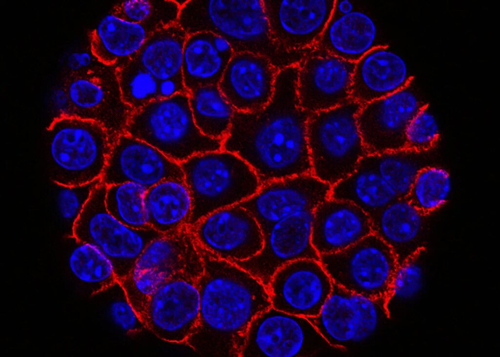 These Supercharged Immune Cells Completely Eliminated Solid Tumors in Mice