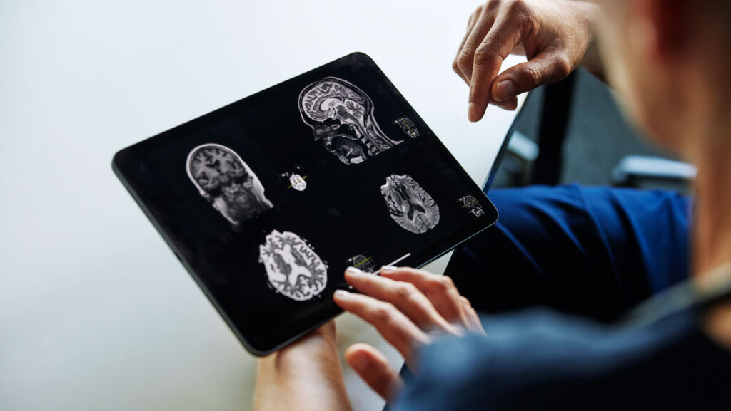 Can AI help doctors avoid missed diagnoses? A new study suggests yes Can AI help doctors avoid missed diagnoses? A new study suggests yes