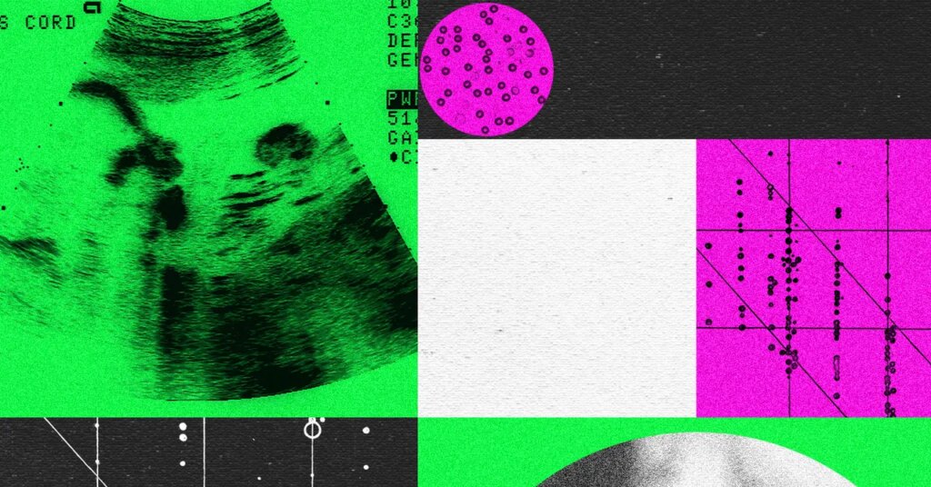 Designer Baby Companies Are in Turmoil Designer Baby Companies Are in Turmoil