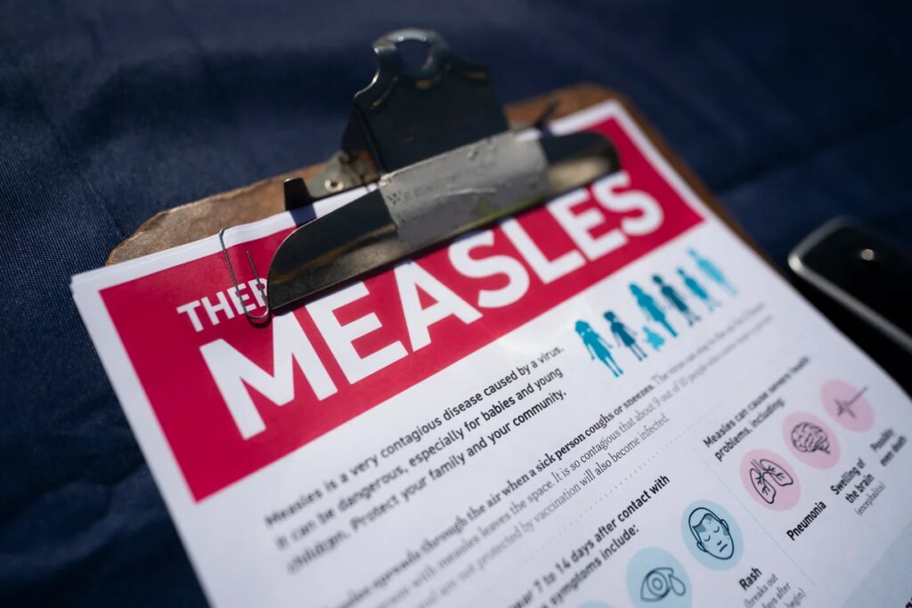 Measles outbreaks can end, but the danger of the disease doesn’t Measles outbreaks can end, but the danger of the disease doesn’t