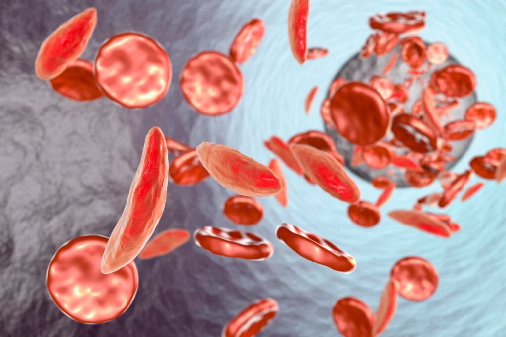 How scientists made the discoveries behind a game-changing gene therapy for sickle cell disease and won a $3-million Breakthrough Prize How scientists made the discoveries behind a game-changing gene therapy for sickle cell disease and won a $3-million Breakthrough Prize