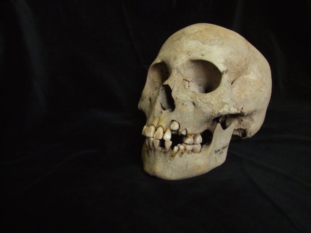 Could this ancient burial site be the oldest lethal plague outbreak? Could this ancient burial site be the oldest lethal plague outbreak?