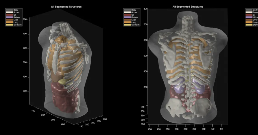 Midjourney Medical goes from AI image generation to full-body ultrasounds Midjourney Medical goes from AI image generation to full-body ultrasounds