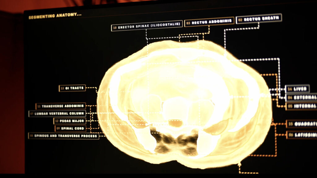 Midjourney, The AI Image Generator, Is Developing A Full-Body Ultrasonic Scanner Midjourney, The AI Image Generator, Is Developing A Full-Body Ultrasonic Scanner