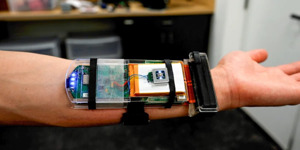 Ultrasound imaging turns a robot hand into a skillful mimic Ultrasound imaging turns a robot hand into a skillful mimic