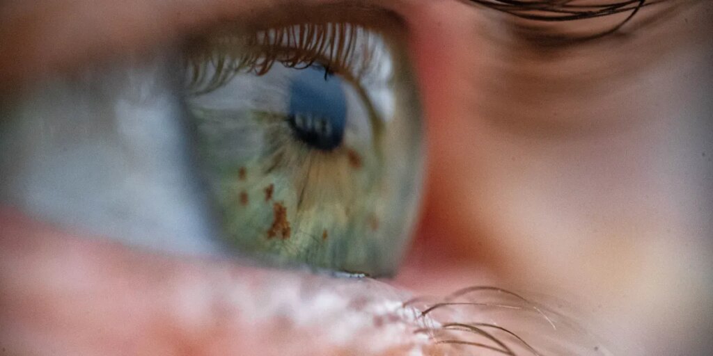A device that revives eyeballs from dead donors could make eye transplants possible A device that revives eyeballs from dead donors could make eye transplants possible